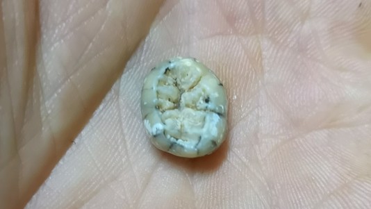 Denisovan tooth from Laos